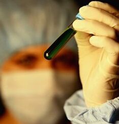 как да се изследваме за паразити