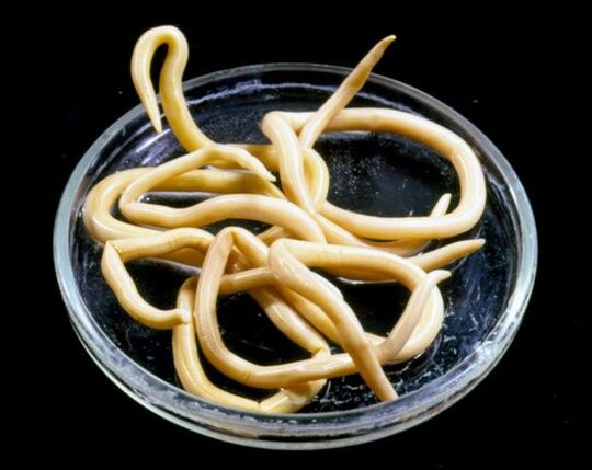 червеи от човешкото тяло