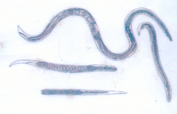 Гвинейският червей, който паразитира под кожата, лесно се заразява
