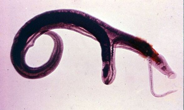 Шистозомите са едни от най-често срещаните и опасни паразити